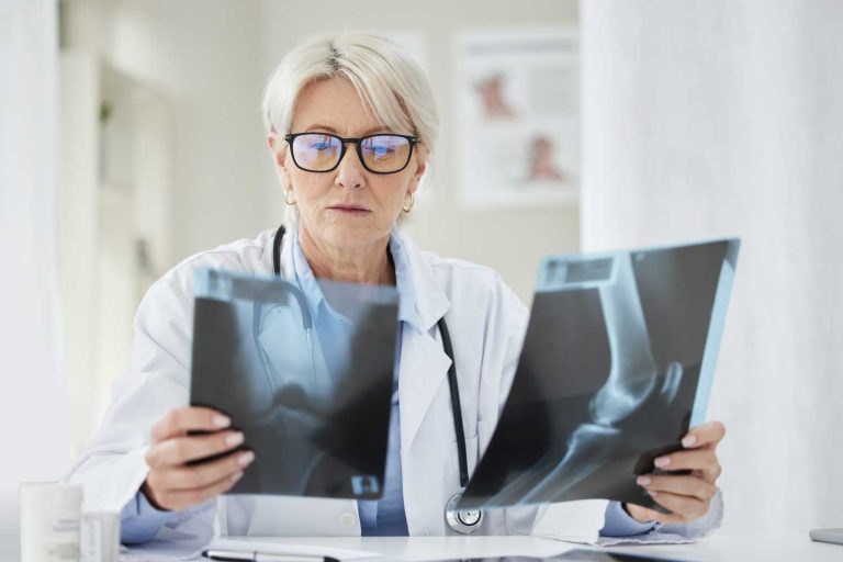 Can You See Osteoporosis on an X-Ray?