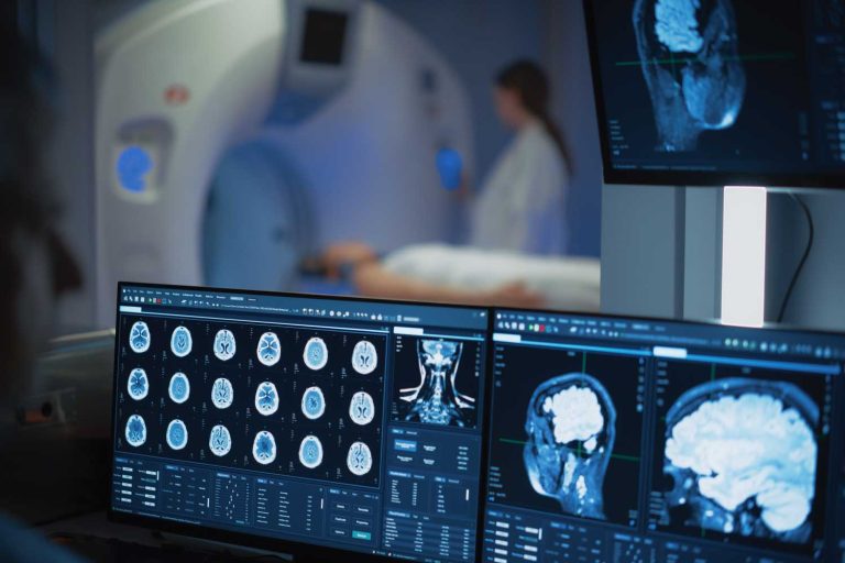 How MRI Helps Detect and Evaluate a Brain Aneurysm