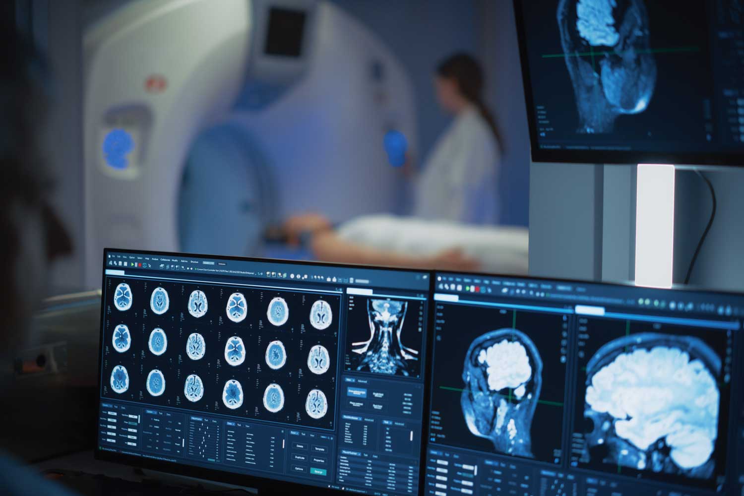 How MRI Helps Detect and Evaluate a Brain Aneurysm