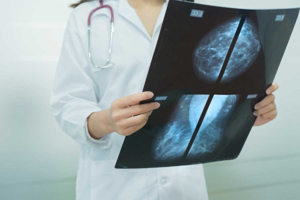 Breast Density Measurement May Predict Cancer Risk