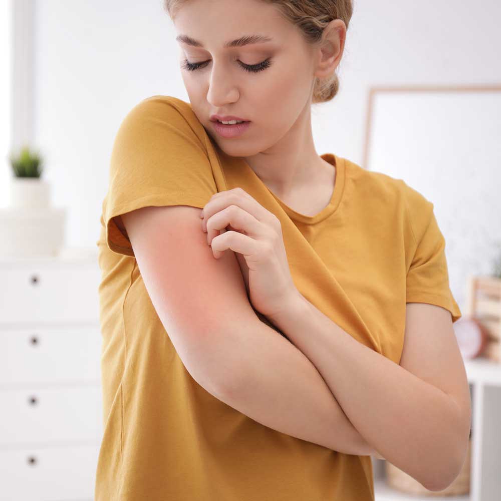 Care for Bites and Stings
