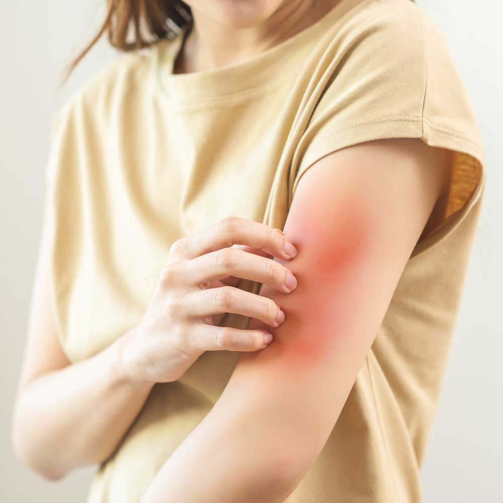 Skin Rashes Treatment