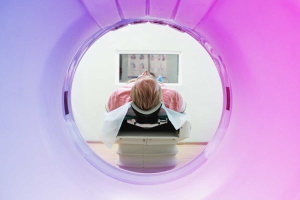 cranial-ct-scan Cranial CT Scan: A Guide to Head and Brain Imaging