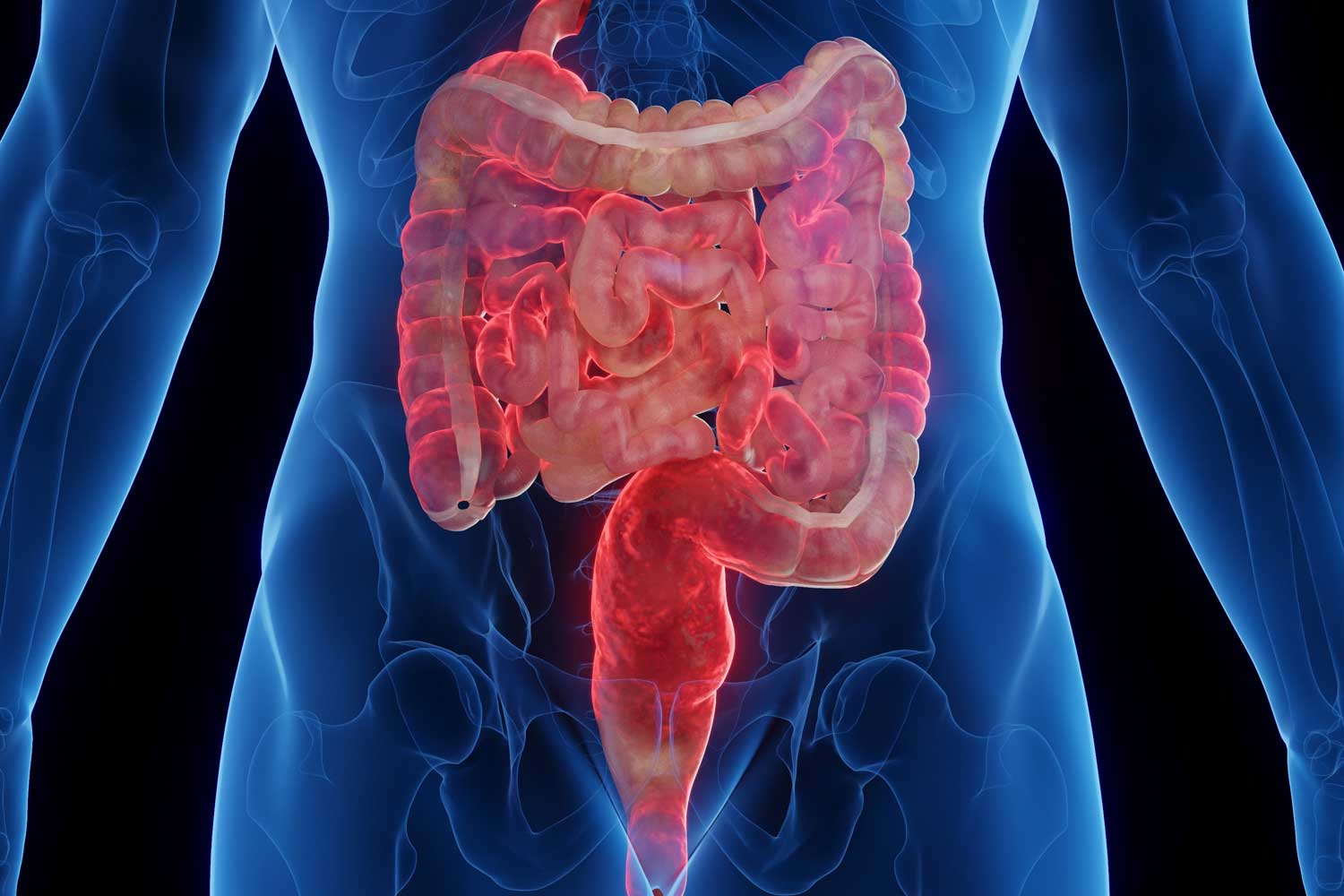 Crohn’s Disease and Radiology: The Essential Role of Imaging in Diagnosis and Management