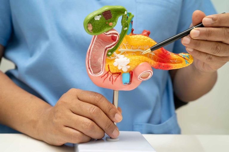 CT Scan for Pancreatic Cancer: What It Shows and How It Helps