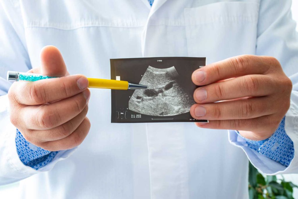 Gallbladder Ultrasound: The Best First Test for Gallstones and Biliary ...