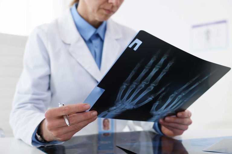 Hand X-Ray: Fast Imaging for Injuries, Arthritis, and Joint Conditions