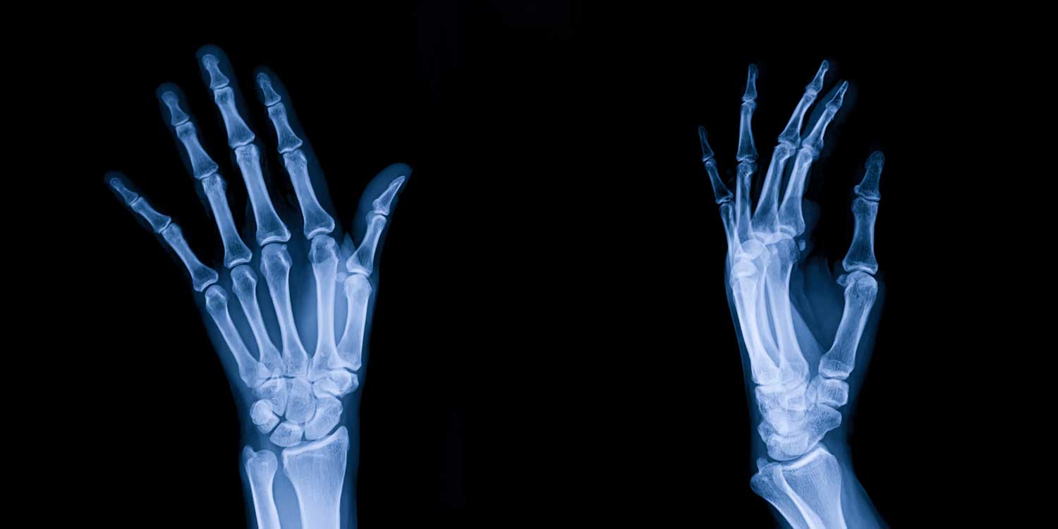 Hand X-ray imaging at IPMC radiology center in Northeast Philadelphia