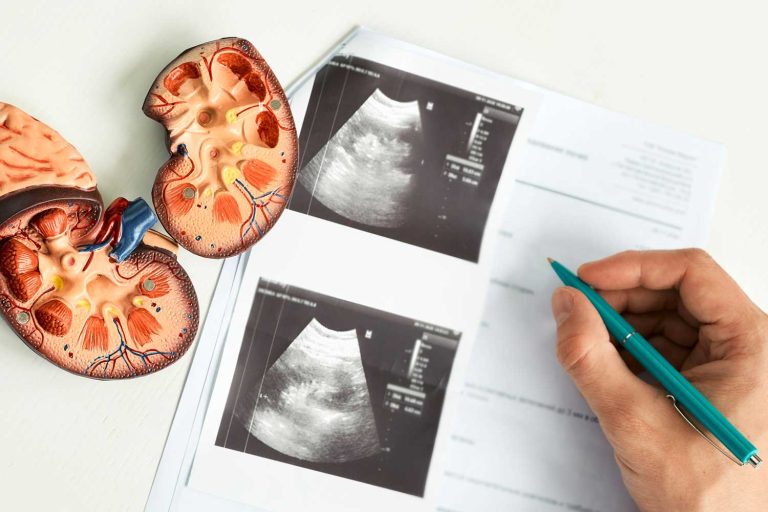 Kidney Ultrasound: What It Shows, Why It’s Done, and What to Expect