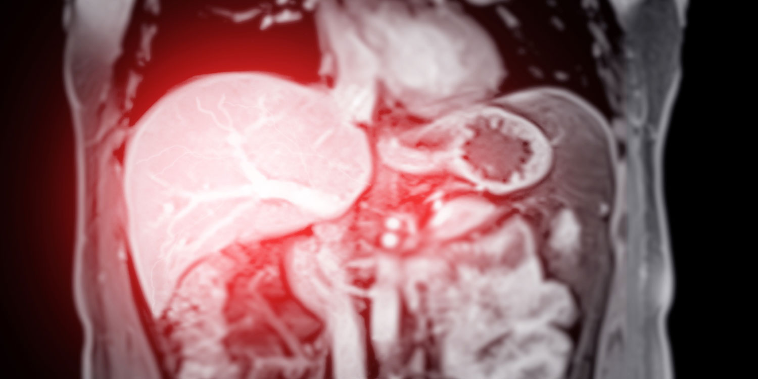 MRI abdomen coronal views are particularly useful for assessing liver, kidneys, and other abdominal organs with precision