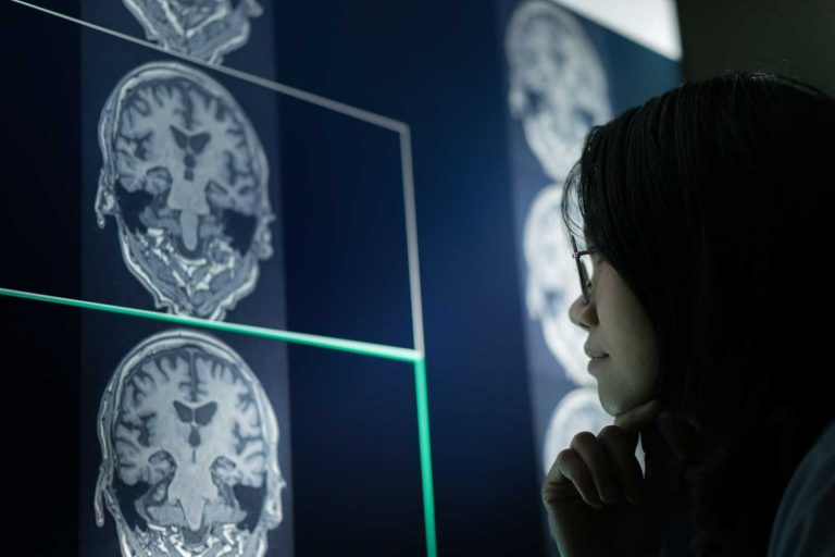 MRI and Parkinson’s Disease: How Imaging Helps with Diagnosis