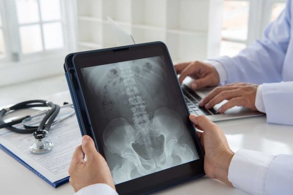Pelvis X-Ray: What It Shows and Why Your Doctor May Order One