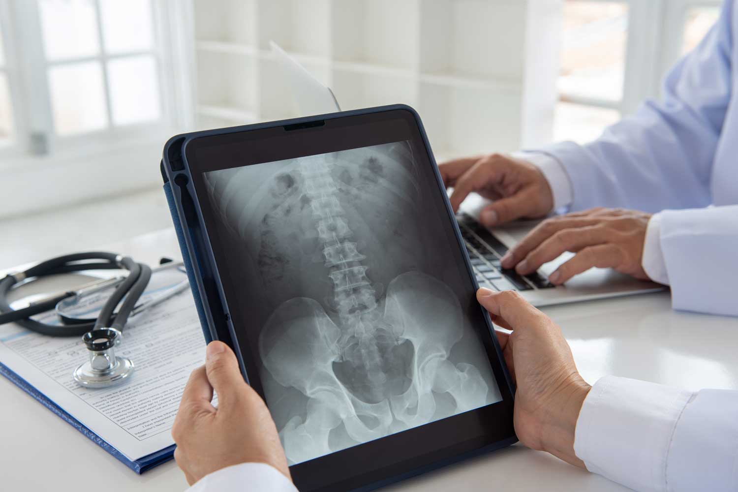 Pelvis X-Ray: What It Shows and Why Your Doctor May Order One