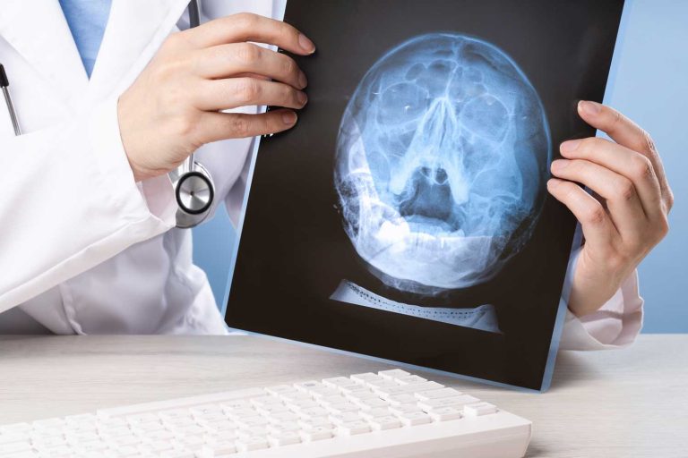 Sinus X-Ray: Evaluating Sinus Problems with Quick, Painless Imaging