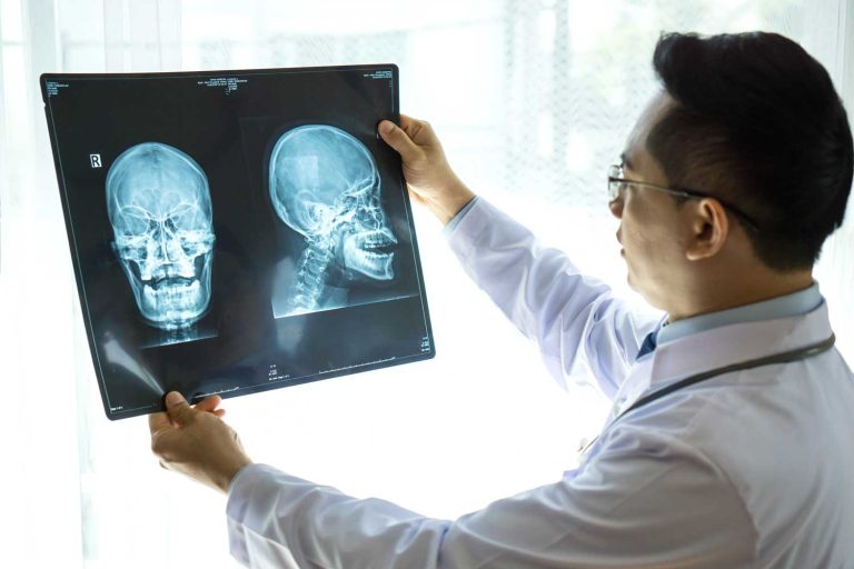 Skull X-Ray: What It Shows, When It’s Needed, and What to Expect