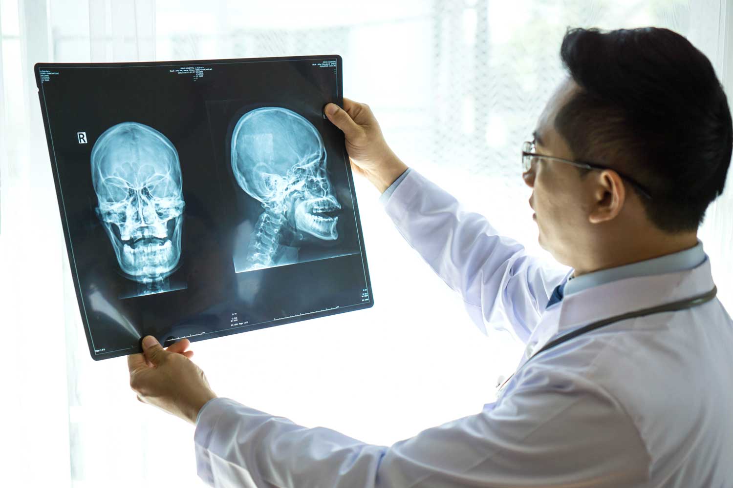 Skull X-Ray: What It Shows, When It’s Needed, and What to Expect