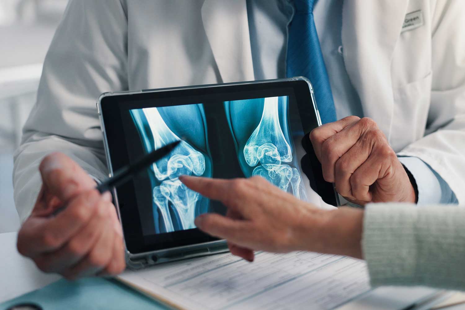 X-Ray for Knee Osteoarthritis: Understanding Joint Wear and Diagnosing Arthritis